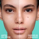 suero-facial-de-niacinamida