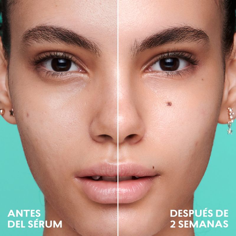 suero-facial-de-niacinamida